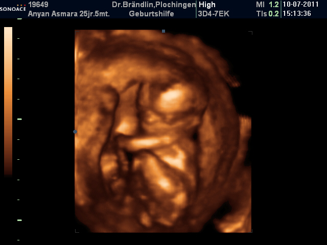 6-month old Judah in the womb