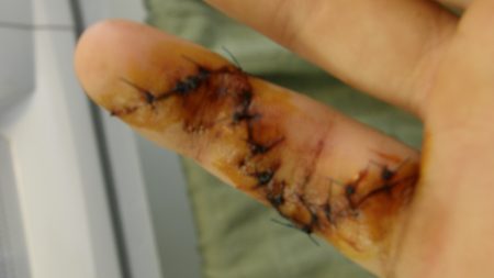 Cody Cuts Finger -Postpones Schooling Aug., 2011