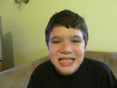 BRACES!